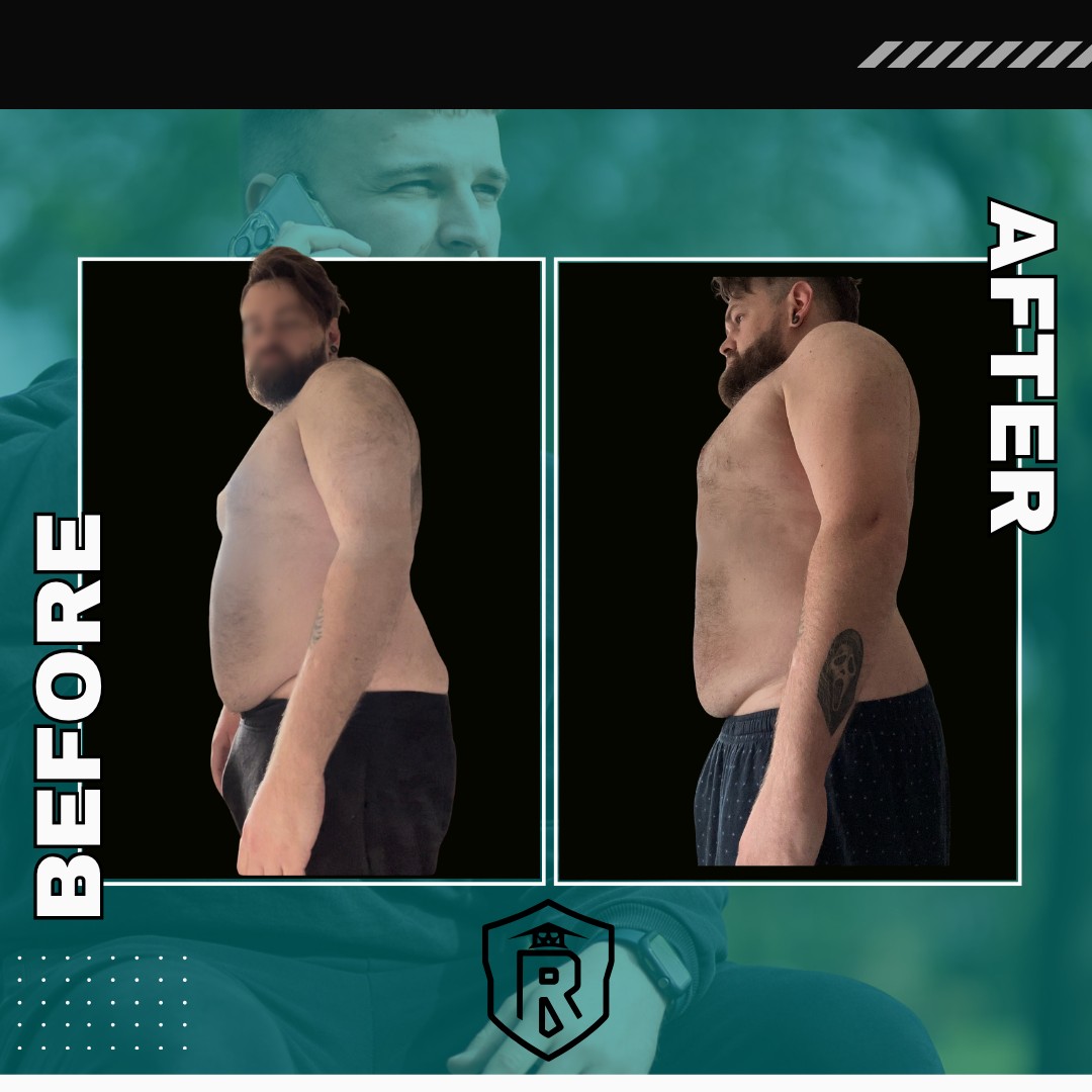 Ryan — before and after